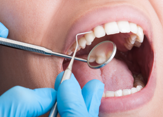 歯科医院でメンテナンスを受けましょう