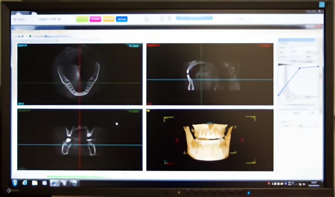 歯科用CT完備
