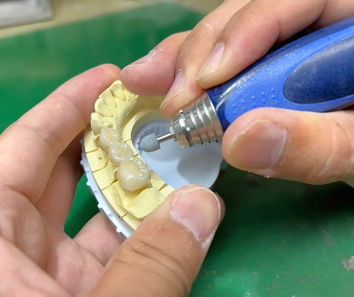 天然歯に近い色調と質感を再現する素材を使用しています