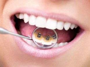 人と接する機会が多い方にも選ばれている治療方法です