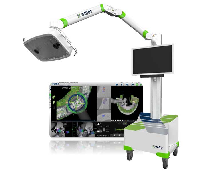 インプラントナビゲーションシステム「X-Guide(Xガイド)」