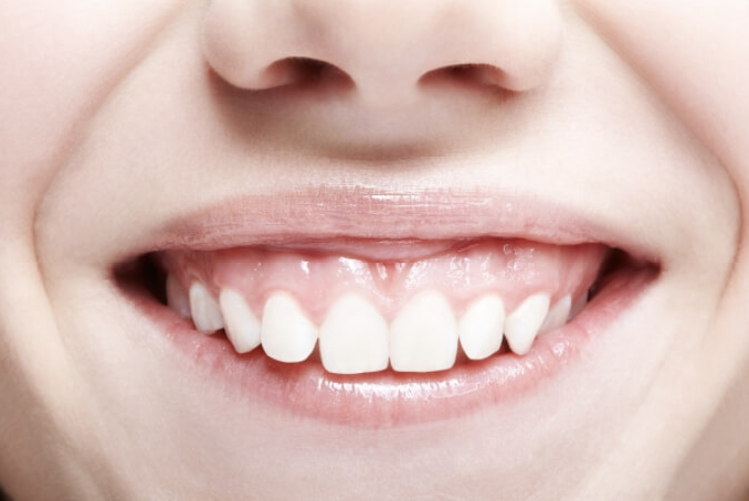 「ガミースマイル」の改善を目指した歯肉整形治療を行っています