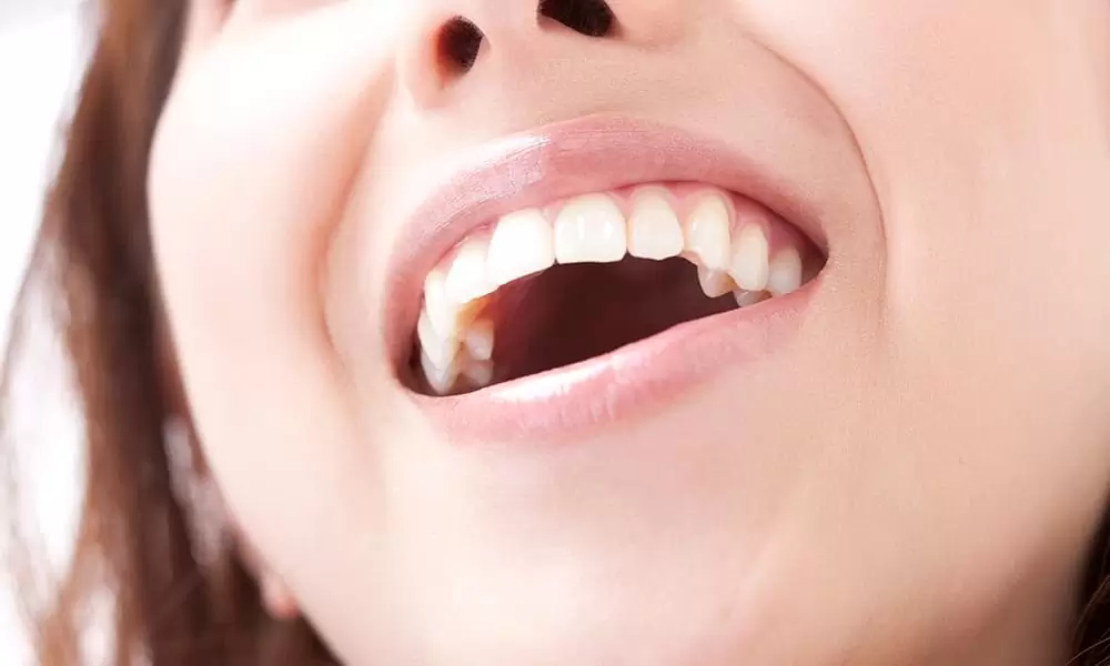 見た目の美しさだけでなく、機能面も考慮したバランスの取れた治療を提供