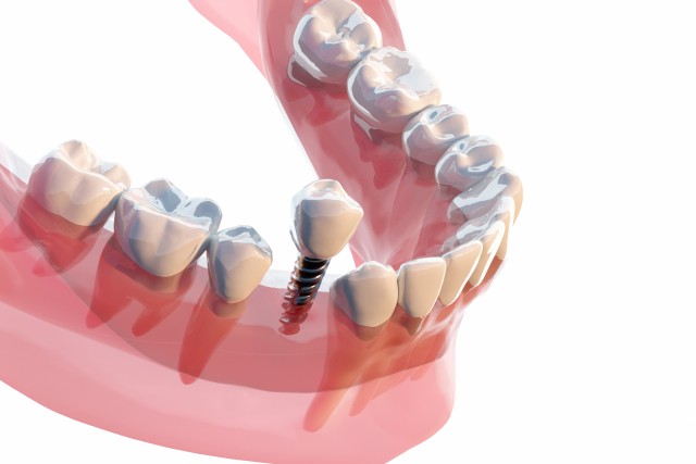 写真はイメージです