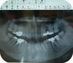 デジタルレントゲン完備