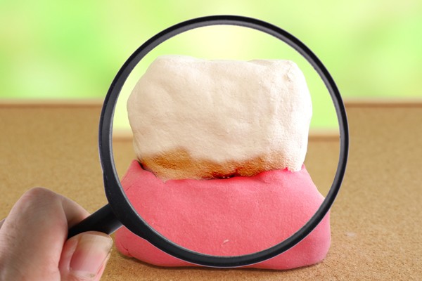 患者様がいつまでもご自身の歯で快適に過ごせるよう継続的にサポートしています。