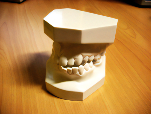 咬み合わせ治療