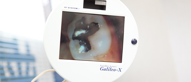 PMTCやブラッシング指導などを通して予防治療に努めています