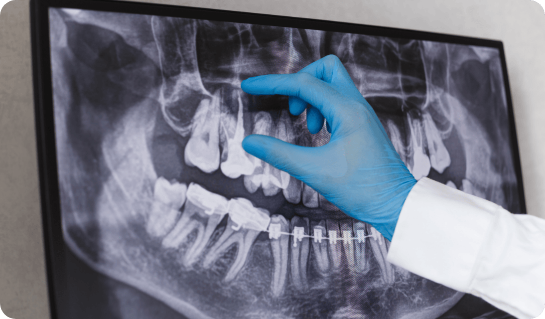 【JR鹿児島線 吉塚駅より徒歩5分】患者様の口腔環境を良好にするため勤しみ丁寧な歯科治療をご提供するACTデンタルクリニック博多