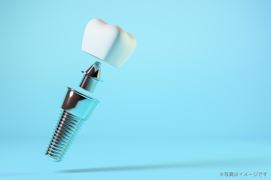 患者様のライフスタイルや希望に応じて、適した方法を提案する対応が取られています