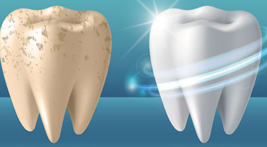 お口元の美しさと健康を追求する審美歯科
