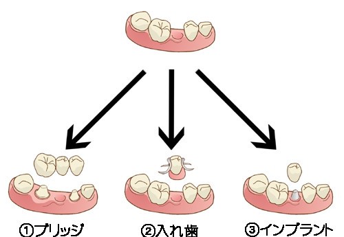 最適な治療法をご提案いたします