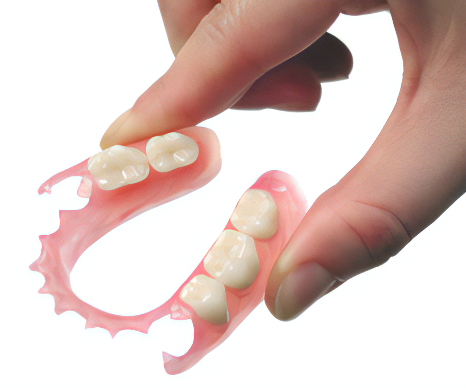 フレキシブルデンチャー