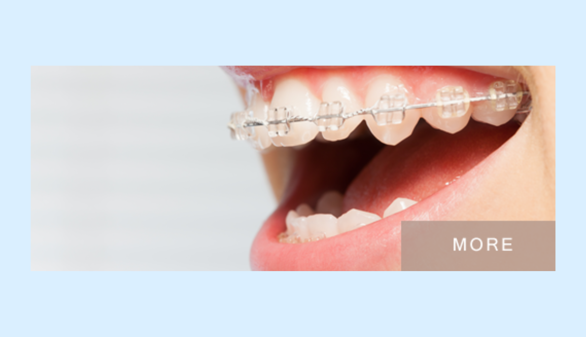 年齢に応じた矯正治療