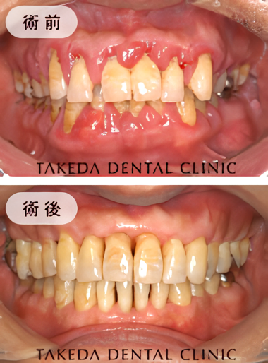 武田歯科医院で治療した患者様の一例です