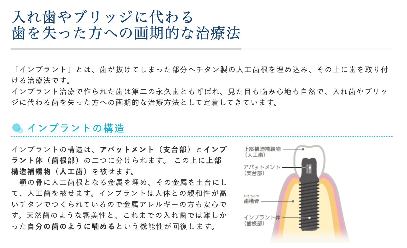 周囲の健康な歯に負担をかけることなくしっかりと固定できるのが特徴です