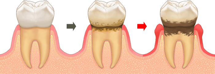 将来の矯正治療をスムーズに進められるようサポートします