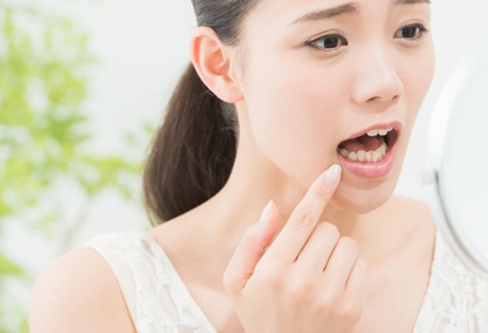 歯を残すために、再発リスクを抑えた治療