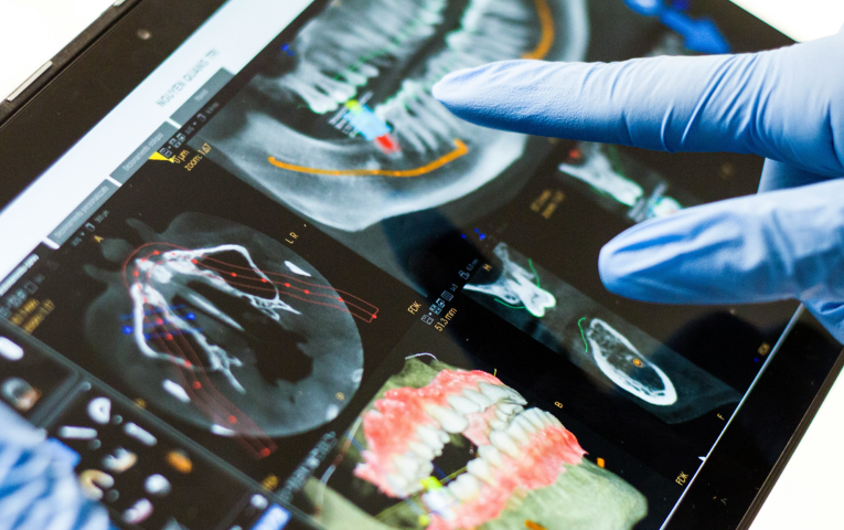 一人ひとりに合った快適な義歯を提案