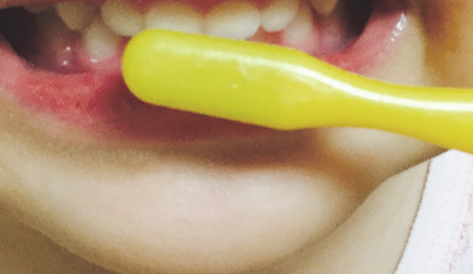 お子様のお口を健やかに保ちましょう