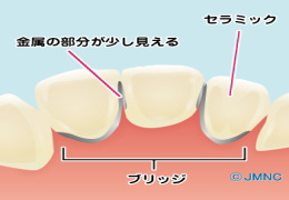 矯正はお子様から大人の方まで幅広い年代で行うことができます