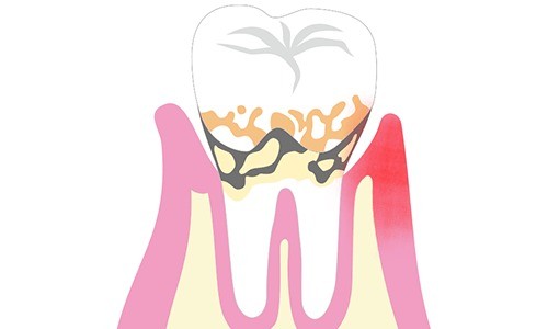 患者様が健康なお口を長く保てるよう丁寧なサポートを行っています。