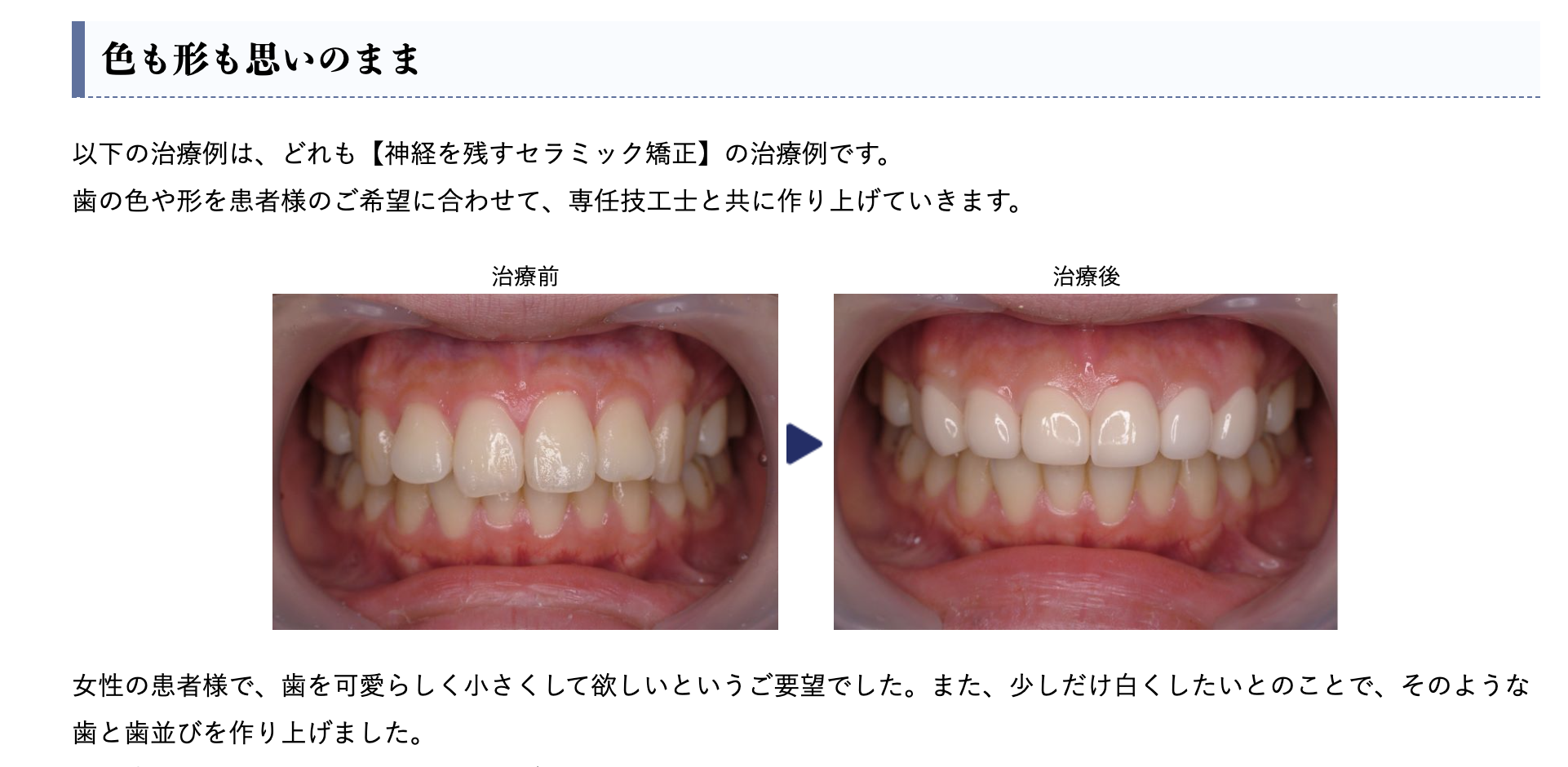 セラミック矯正を通じて歯並びや見た目の改善を目指す治療を提供しています