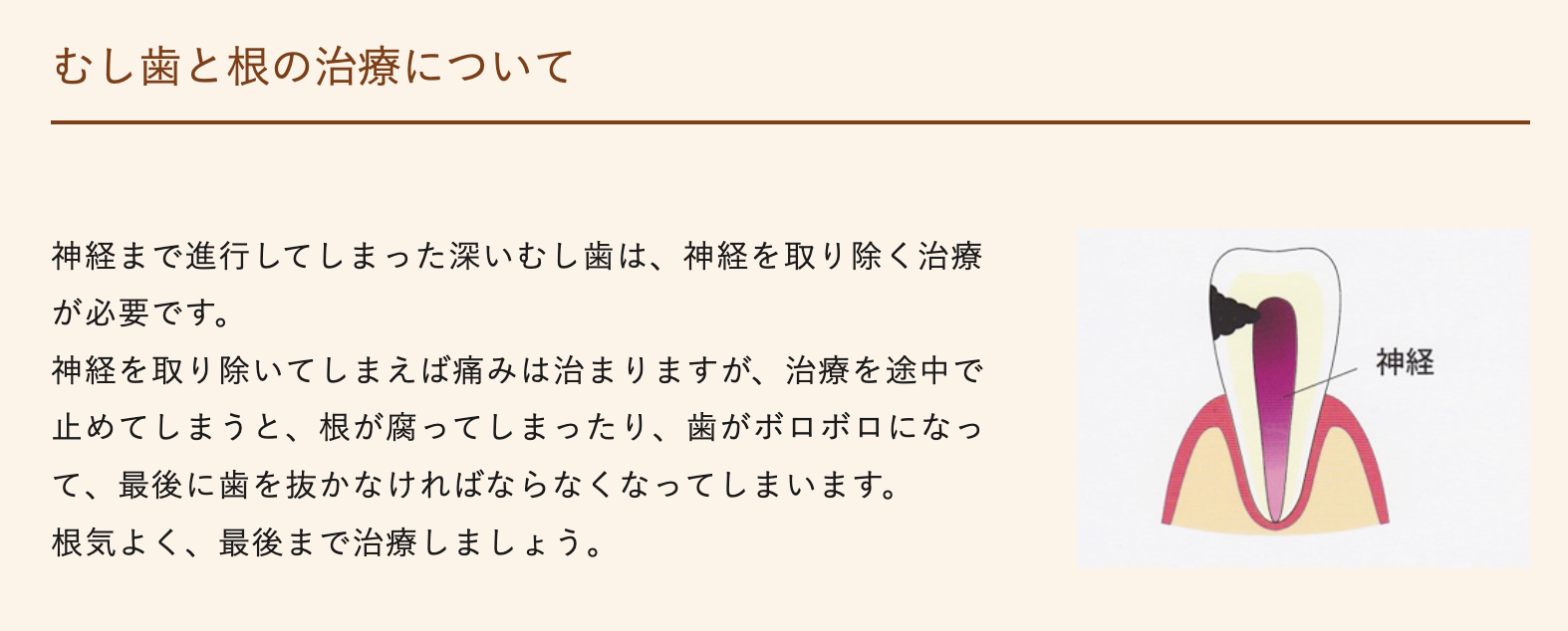 歯をできる限り残し、長く健康な状態を保つことを目指した治療を行っています