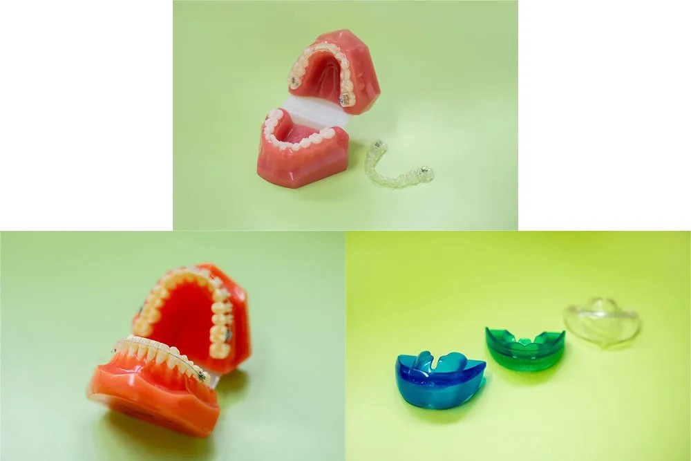 多様な矯正装置により幅広い症例に対応