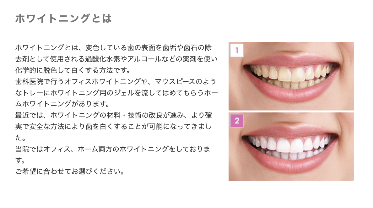 オフィスホワイトニングとホームホワイトニングの2種類をご用意しています