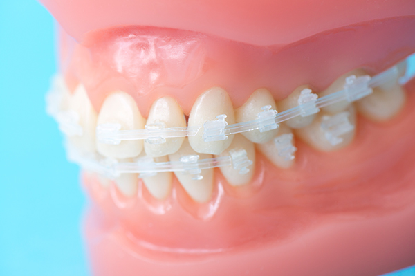 美しい歯並びは全身の健康につながります