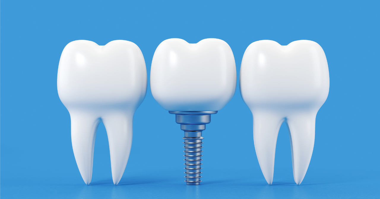 ※画像はイメージです。