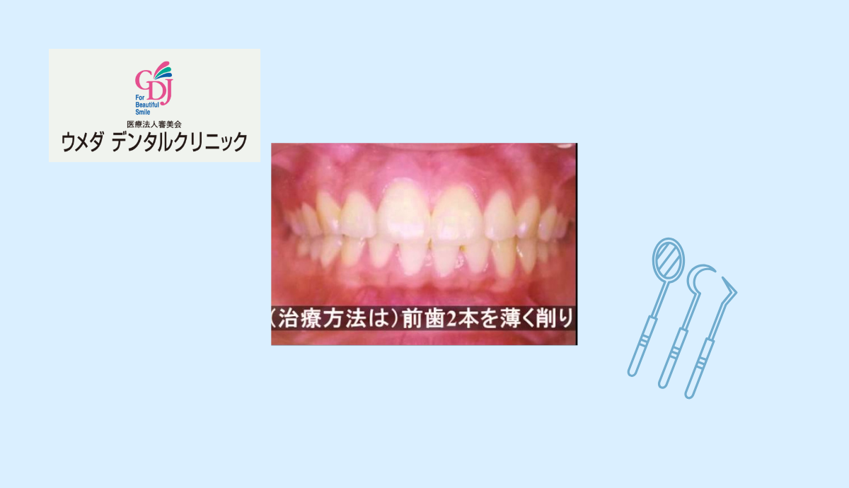 信頼関係を大切にした丁寧なステップ