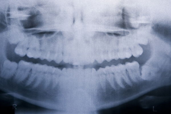 ※画像はイメージです