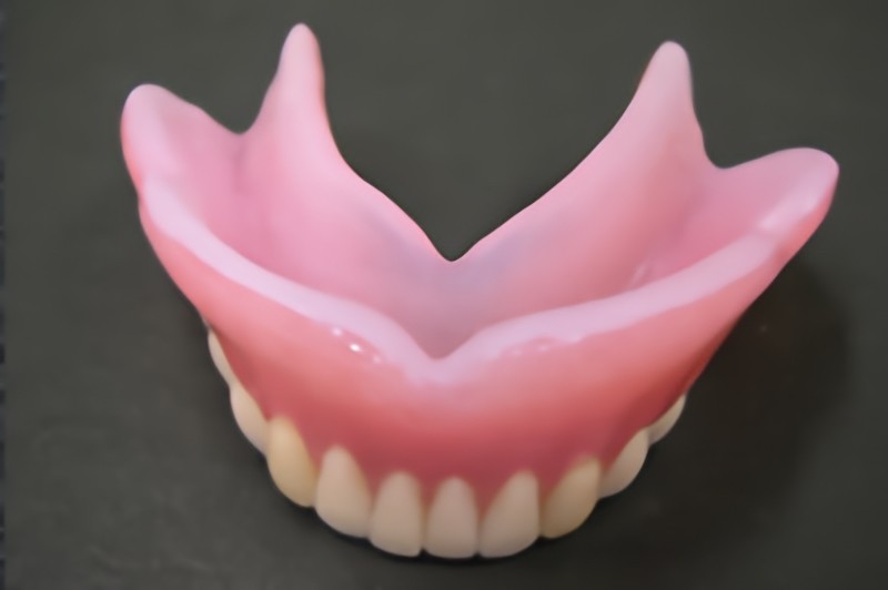 コンフォート義歯