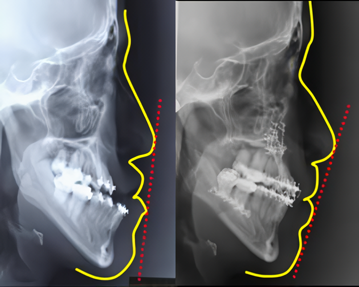 顎変形症に対して、専門的な外科矯正手術を中心とした治療を提供しています