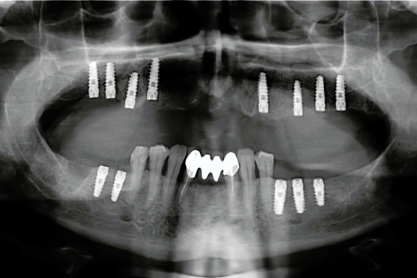 ※画像はイメージです