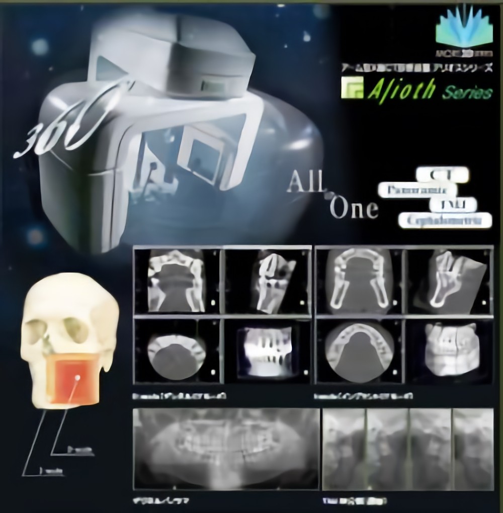 CTを活用した精密なインプラント治療
