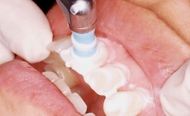 共に歯の健康を守っていきましょう