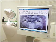 確かな技術と経験で安心のインプラント治療を提供