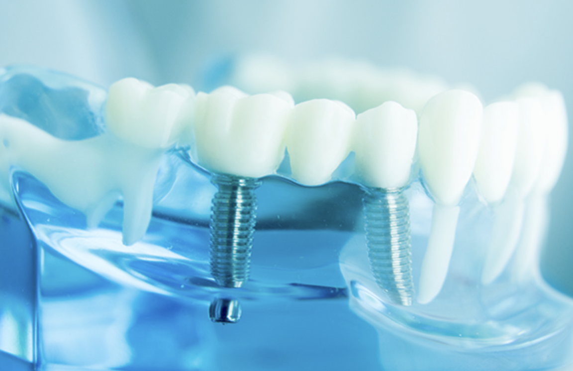 患者様の状態に応じた選択肢を提示し、納得のいく治療を提供できるよう努めています