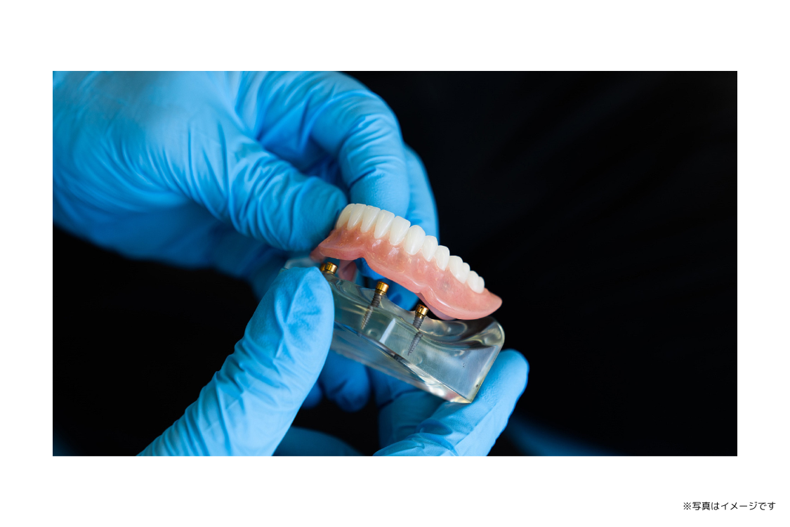 入れ歯の悩みに対して、丁寧な診察と工程を通じて対応しています