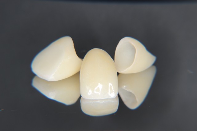 写真はイメージです