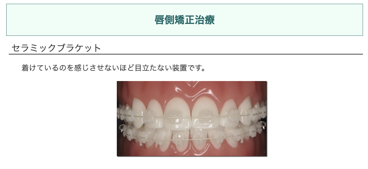 歯の表側に装置を装着し、自然な見た目で矯正を進められる方法を提供しています