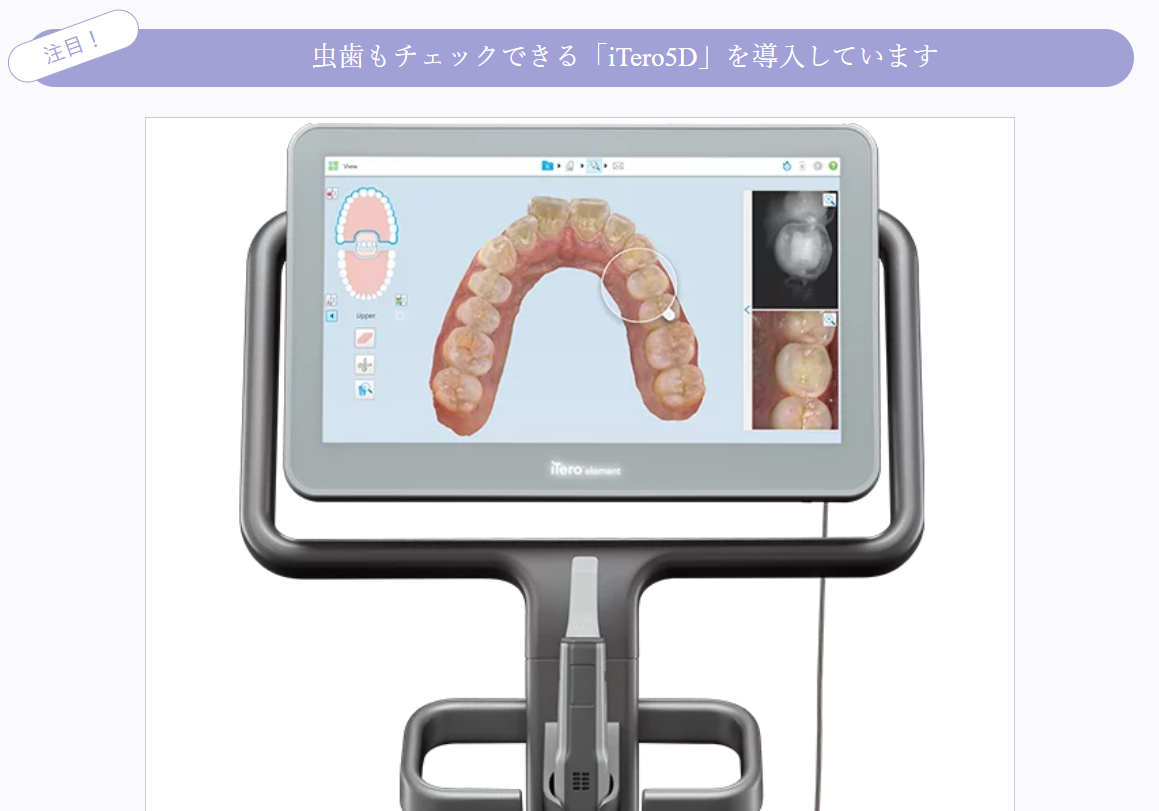 虫歯もチェックできる「iTero5D」を導入しています