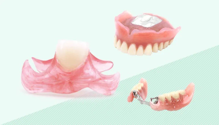 コンフォートデンチャー