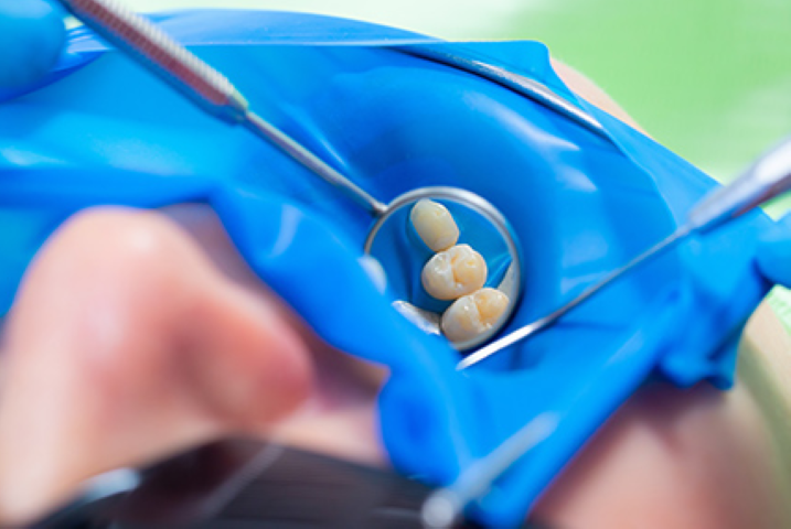 プロによるケアで予防を習慣に