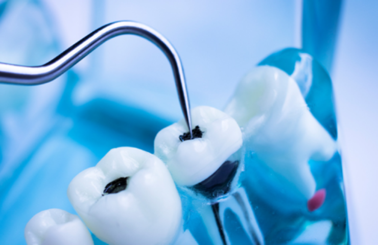 痛みを抑えた治療で虫歯の進行を防ぐ滝沢歯科医院