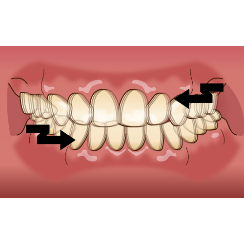 早期治療が大切です