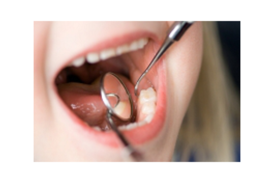 女性ドクターが治療を行います